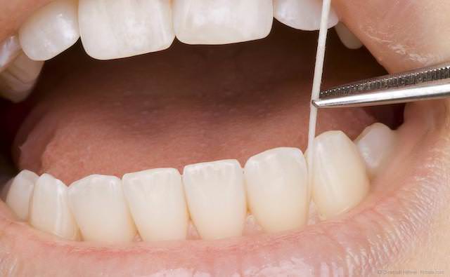 Tote Zähne auf Ausscheidung von Giften testen